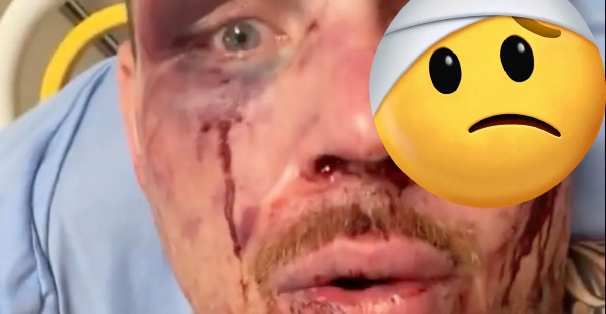 Steven Asplund Suffers First Octagon Defeat at UFC Vegas 114